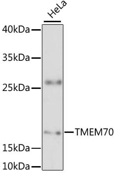 Western blot analysis of extracts of HeLa cells, using Anti-TMEM70 Antibody (A13712) at 1:3000 dilution.
Secondary antibody: Goat Anti-Rabbit IgG (H+L) (HRP) (AS014) at 1:10,000 dilution.
Lysates / proteins: 25µg per lane.
Blocking buffer: 3% non-fat dry milk in TBST.
Detection: ECL Basic Kit (RM00020).
Exposure time: 90s.