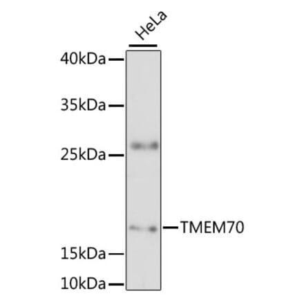 Western Blot - Anti-TMEM70 Antibody (A88600) - Antibodies.com