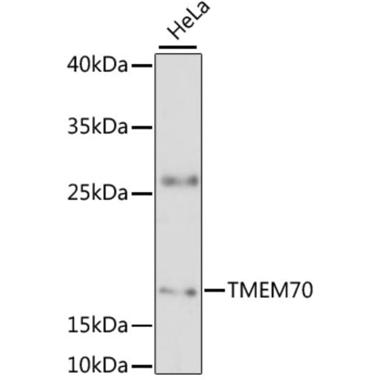 Western Blot - Anti-TMEM70 Antibody (A88600) - Antibodies.com