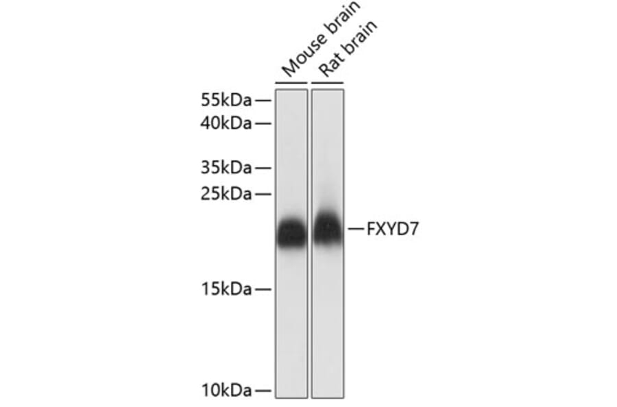 Western Blot - Anti-FXYD7 Antibody (A88601) - Antibodies.com