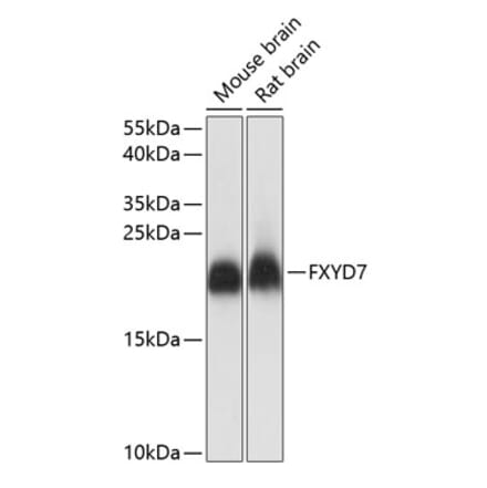 Western Blot - Anti-FXYD7 Antibody (A88601) - Antibodies.com