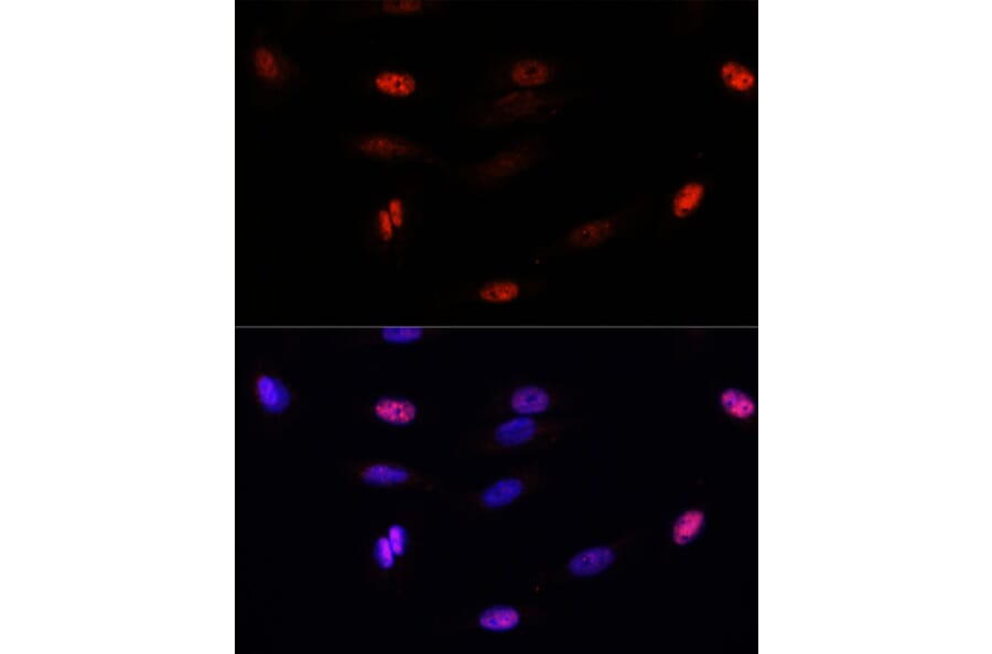 Immunofluorescence - Anti-Sumo 3 Antibody (A88602) - Antibodies.com