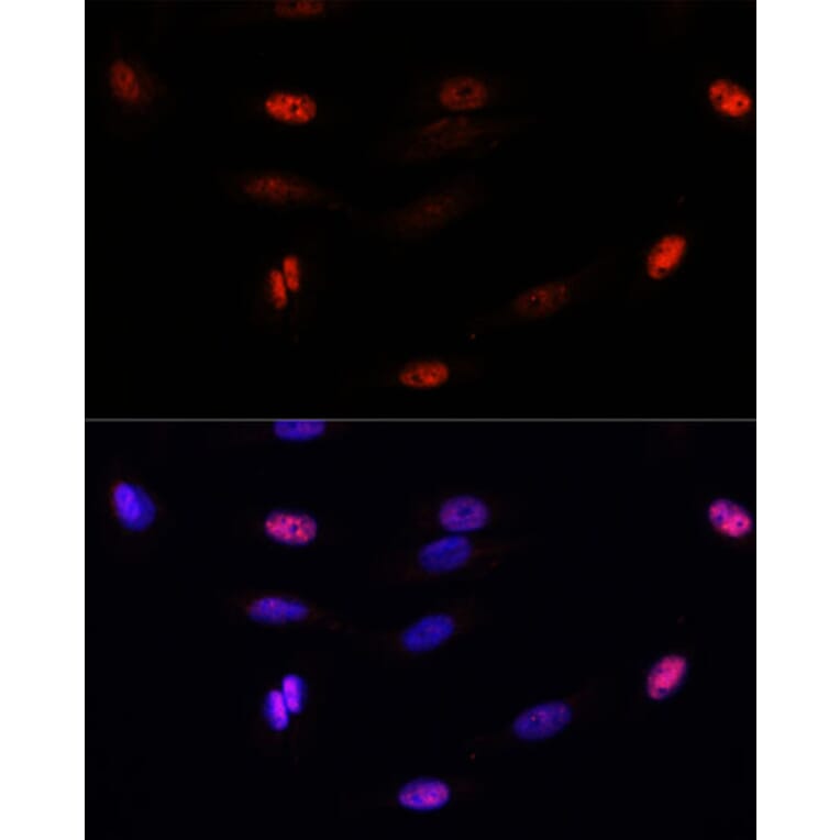 Immunofluorescence - Anti-Sumo 3 Antibody (A88602) - Antibodies.com
