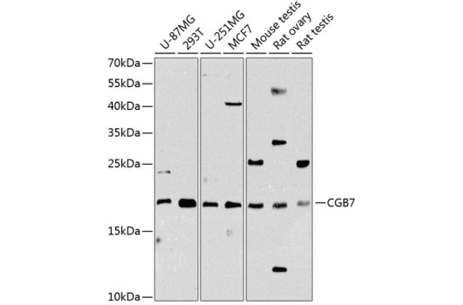 Western Blot - Anti-hCG beta Antibody (A88603) - Antibodies.com