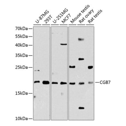 Western Blot - Anti-hCG beta Antibody (A88603) - Antibodies.com