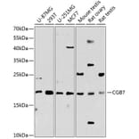 Western Blot - Anti-hCG beta Antibody (A88603) - Antibodies.com