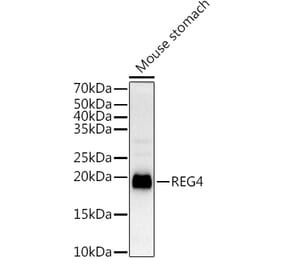 Western Blot - Anti-REG4 Antibody (A88604) - Antibodies.com