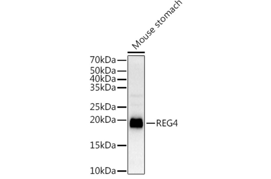 Western Blot - Anti-REG4 Antibody (A88604) - Antibodies.com