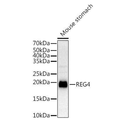 Western Blot - Anti-REG4 Antibody (A88604) - Antibodies.com