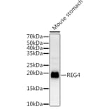 Western Blot - Anti-REG4 Antibody (A88604) - Antibodies.com