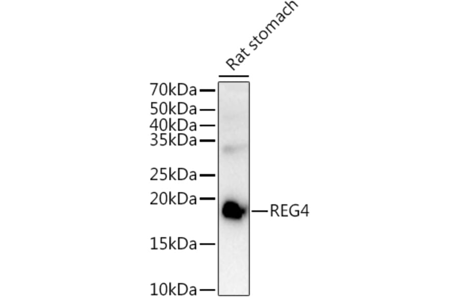 Western Blot - Anti-REG4 Antibody (A88604) - Antibodies.com