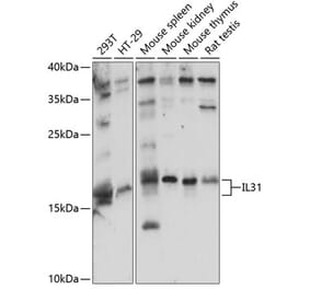 Western Blot - Anti-IL-31 Antibody (A88605) - Antibodies.com