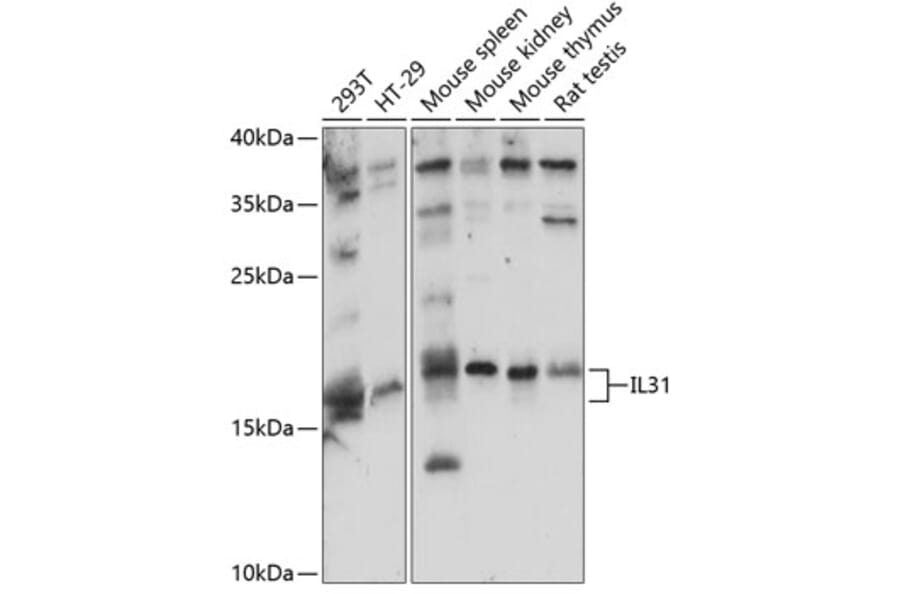Western Blot - Anti-IL-31 Antibody (A88605) - Antibodies.com