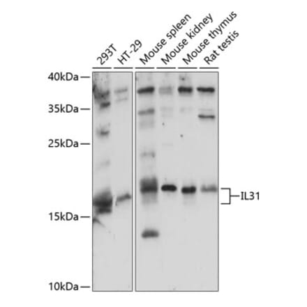 Western Blot - Anti-IL-31 Antibody (A88605) - Antibodies.com