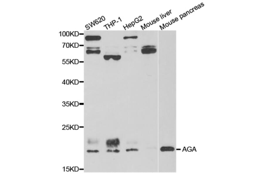 Western Blot - Anti-AGA Antibody (A13942) - Antibodies.com