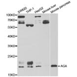 Western Blot - Anti-AGA Antibody (A13942) - Antibodies.com