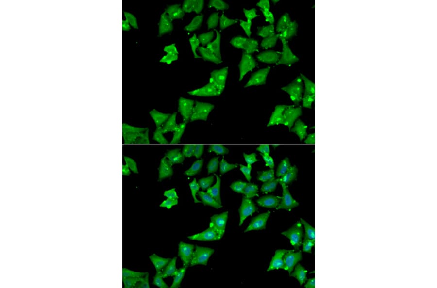 Immunofluorescence - Anti-AGA Antibody (A13942) - Antibodies.com