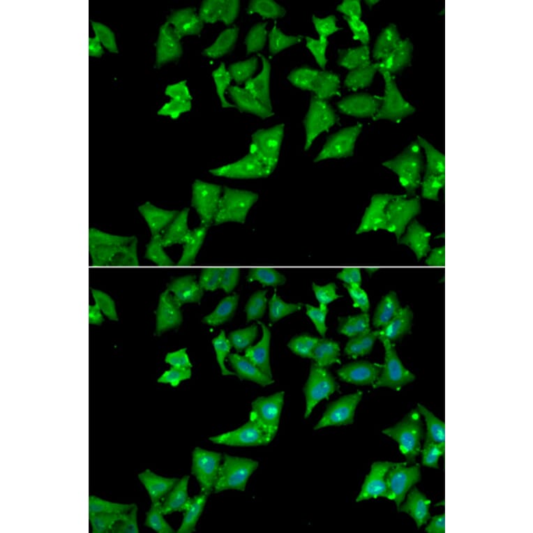 Immunofluorescence - Anti-AGA Antibody (A13942) - Antibodies.com