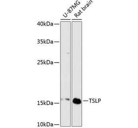 Western Blot - Anti-TSLP Antibody (A88607) - Antibodies.com
