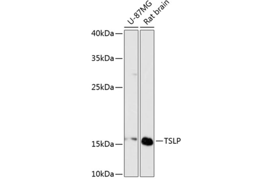 Western Blot - Anti-TSLP Antibody (A88607) - Antibodies.com