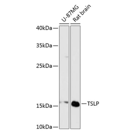 Western Blot - Anti-TSLP Antibody (A88607) - Antibodies.com