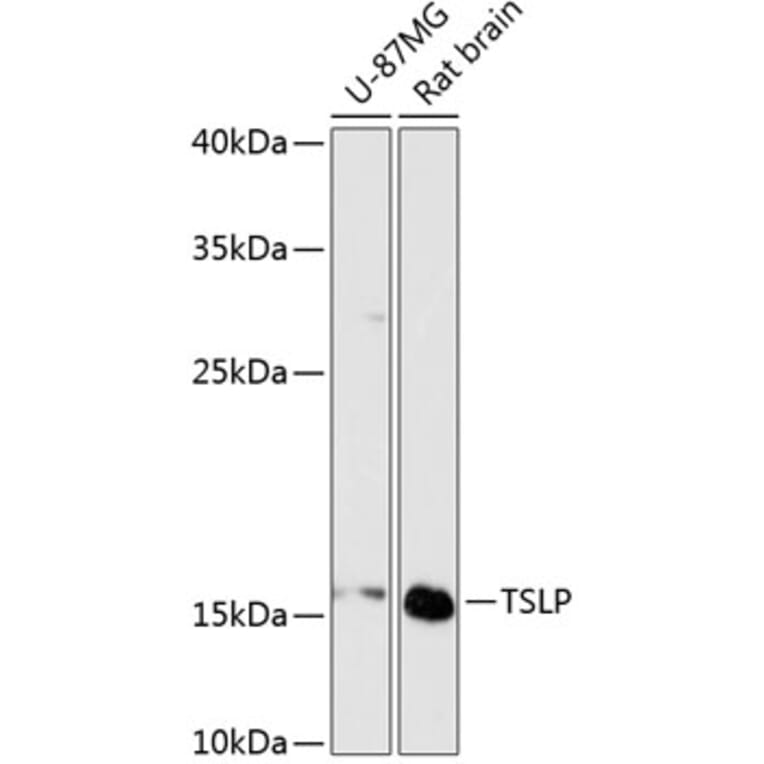 Western Blot - Anti-TSLP Antibody (A88607) - Antibodies.com