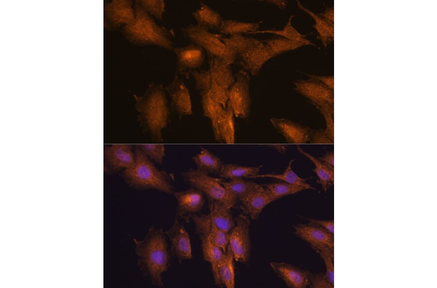 Immunofluorescence - Anti-TSLP Antibody (A88607) - Antibodies.com