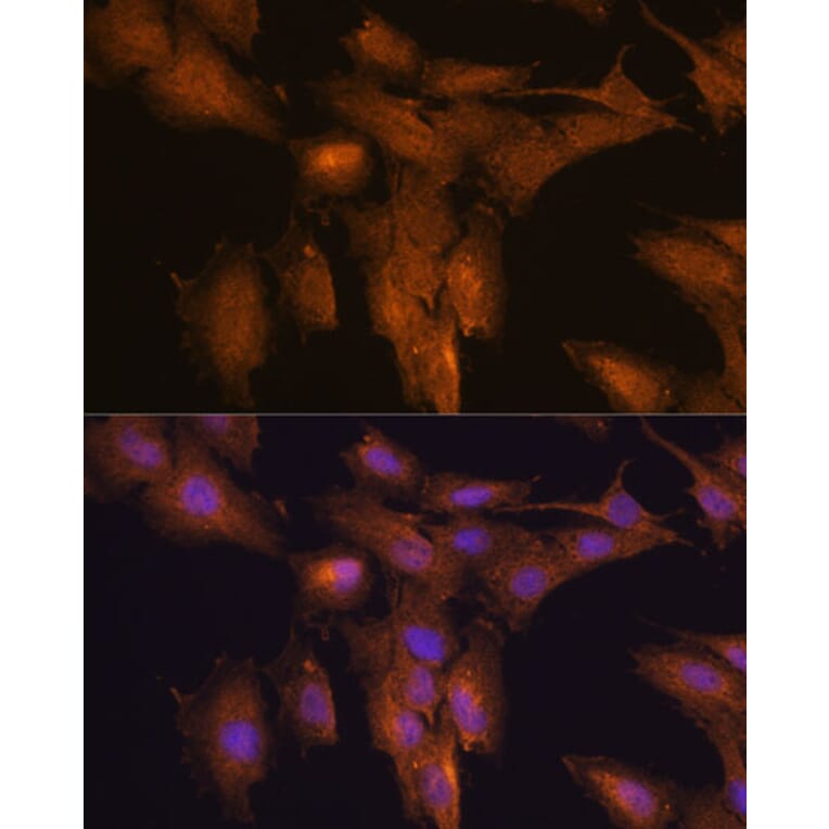 Immunofluorescence - Anti-TSLP Antibody (A88607) - Antibodies.com