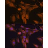 Immunofluorescence - Anti-TSLP Antibody (A88607) - Antibodies.com