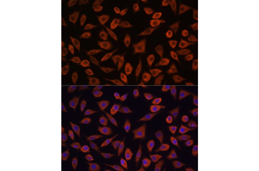 Immunofluorescence - Anti-TSLP Antibody (A88607) - Antibodies.com