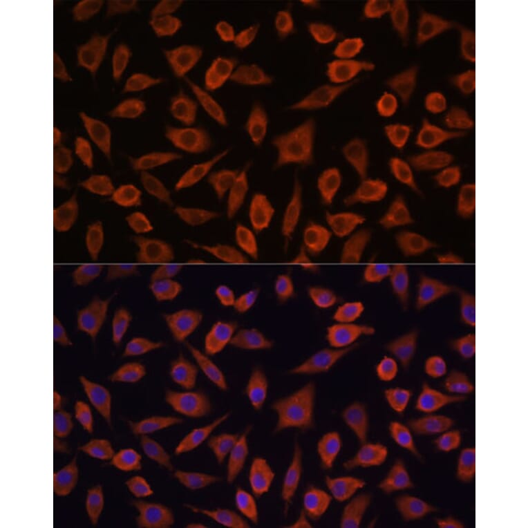 Immunofluorescence - Anti-TSLP Antibody (A88607) - Antibodies.com