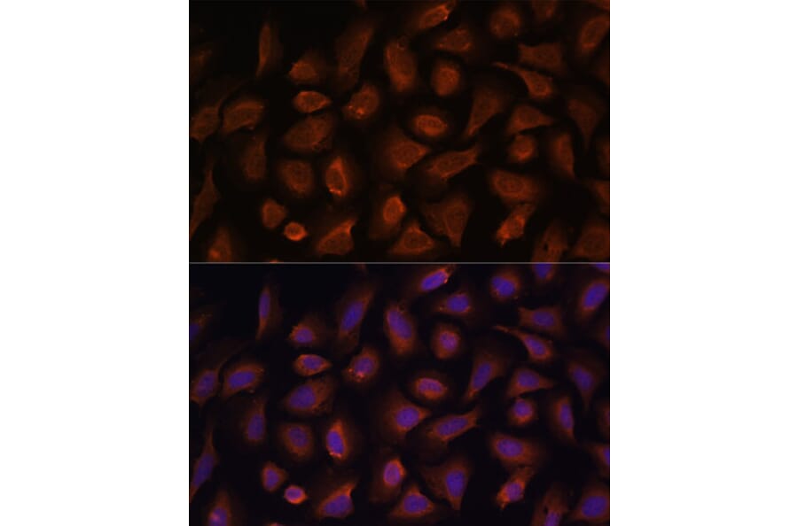 Immunofluorescence - Anti-TSLP Antibody (A88607) - Antibodies.com