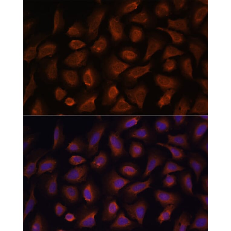 Immunofluorescence - Anti-TSLP Antibody (A88607) - Antibodies.com