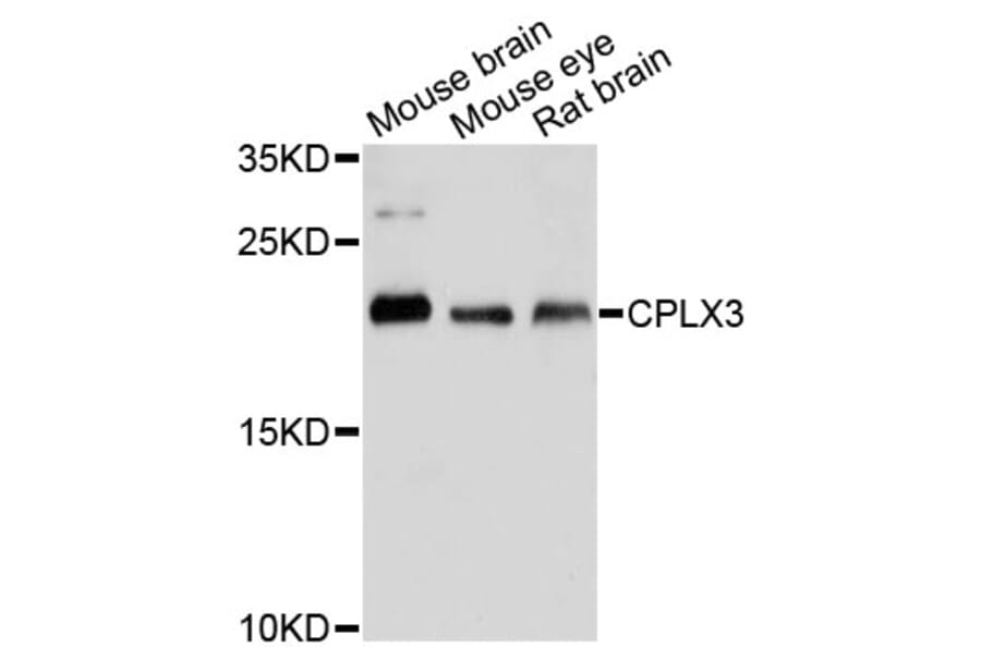 Western Blot - Anti-CPLX3 Antibody (A13694) - Antibodies.com