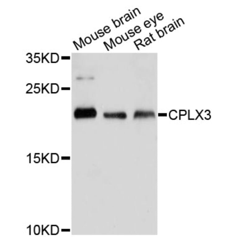 Western Blot - Anti-CPLX3 Antibody (A13694) - Antibodies.com