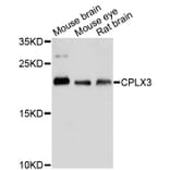 Western Blot - Anti-CPLX3 Antibody (A13694) - Antibodies.com