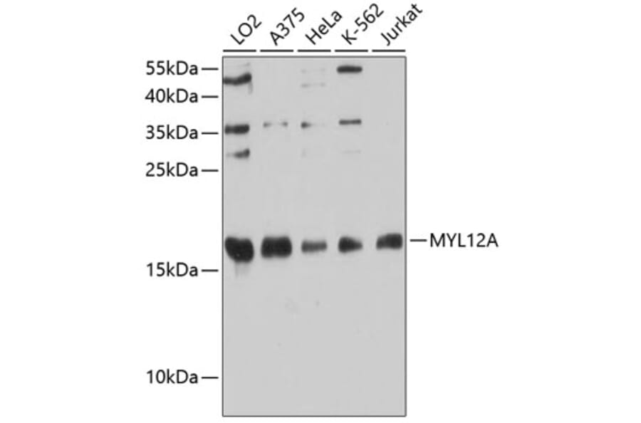 Western Blot - Anti-MYL12A Antibody (A88610) - Antibodies.com