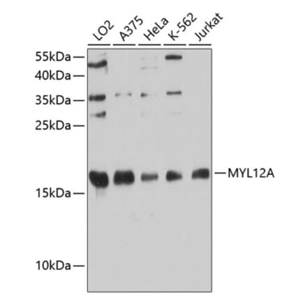 Western Blot - Anti-MYL12A Antibody (A88610) - Antibodies.com