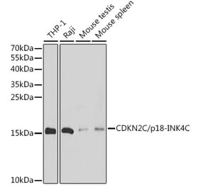 Western Blot - Anti-CDKN2C Antibody (A88611) - Antibodies.com