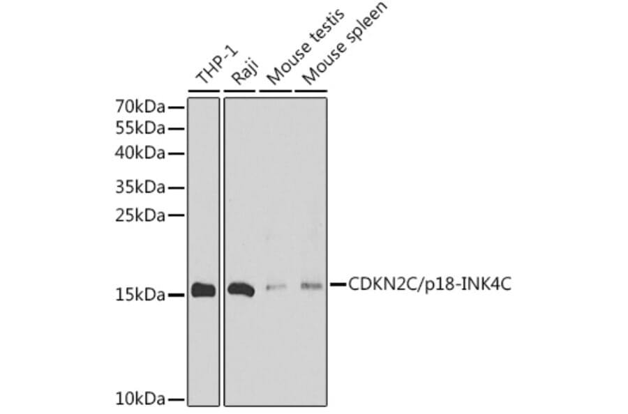 Western Blot - Anti-CDKN2C Antibody (A88611) - Antibodies.com