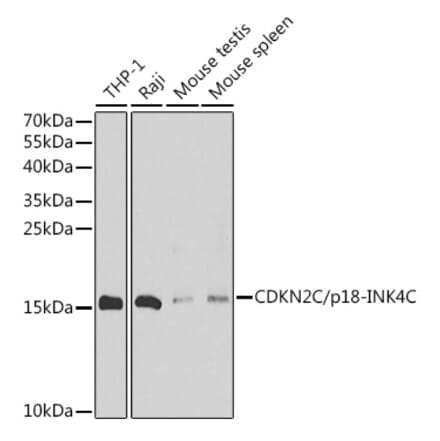 Western Blot - Anti-CDKN2C Antibody (A88611) - Antibodies.com