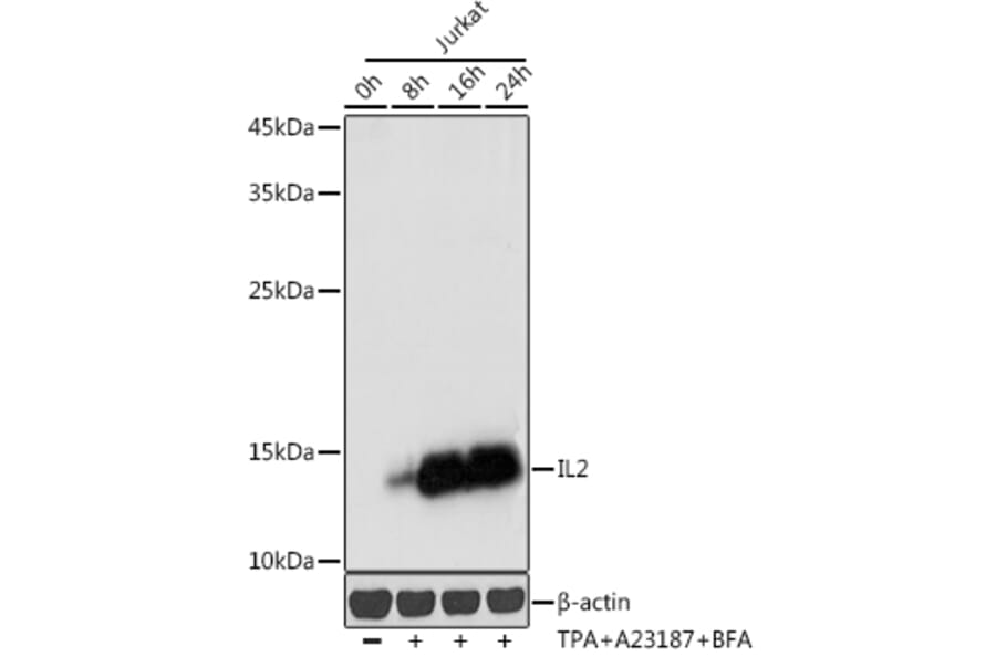 Western Blot - Anti-IL-2 Antibody (A88612) - Antibodies.com
