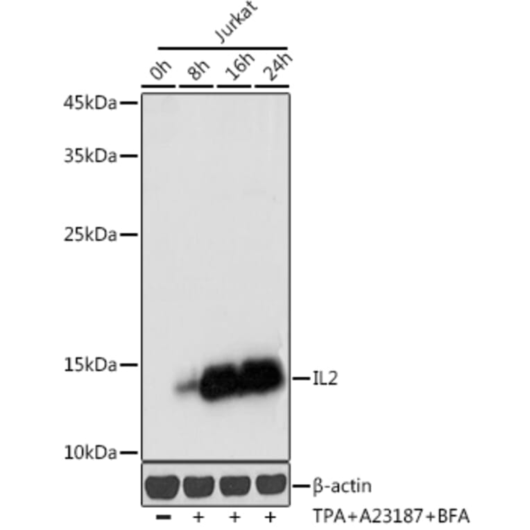 Western Blot - Anti-IL-2 Antibody (A88612) - Antibodies.com