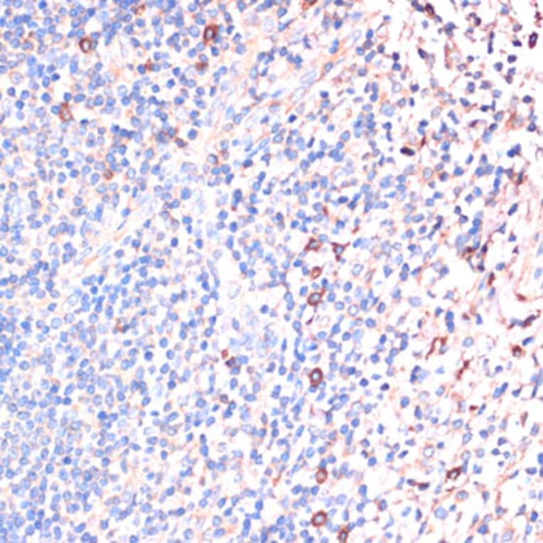 Immunohistochemistry - Anti-IL-2 Antibody (A88612) - Antibodies.com