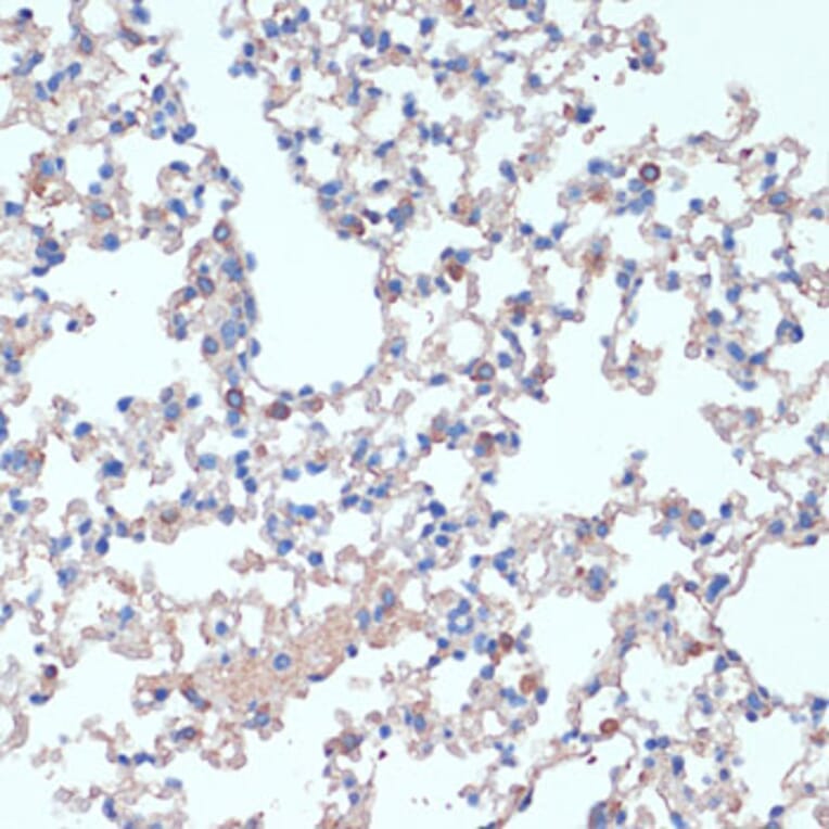 Immunohistochemistry - Anti-IL-2 Antibody (A88612) - Antibodies.com