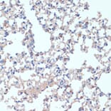 Immunohistochemistry - Anti-IL-2 Antibody (A88612) - Antibodies.com