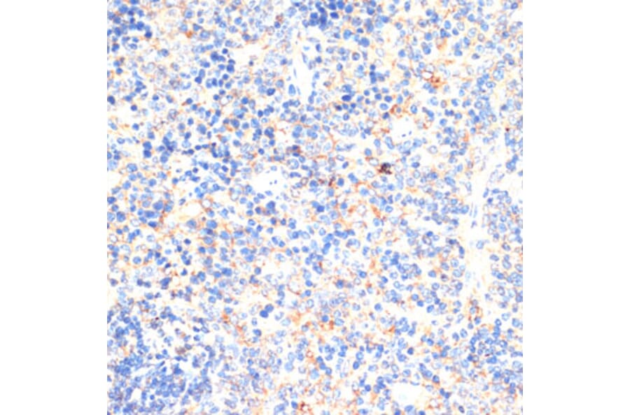 Immunohistochemistry - Anti-IL-2 Antibody (A88612) - Antibodies.com