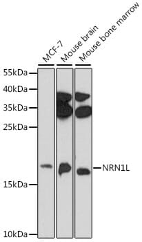 Western blot analysis of extracts of various cell lines, using Anti-NRN1L Antibody (A16594) at 1:1,000 dilution.
Secondary antibody: Goat Anti-Rabbit IgG (H+L) (HRP) (AS014) at 1:10,000 dilution.
Lysates / proteins: 25µg per lane.
Blocking buffer: 3% non-fat dry milk in TBST.
Detection: ECL Basic Kit (RM00020).
Exposure time: 10s.