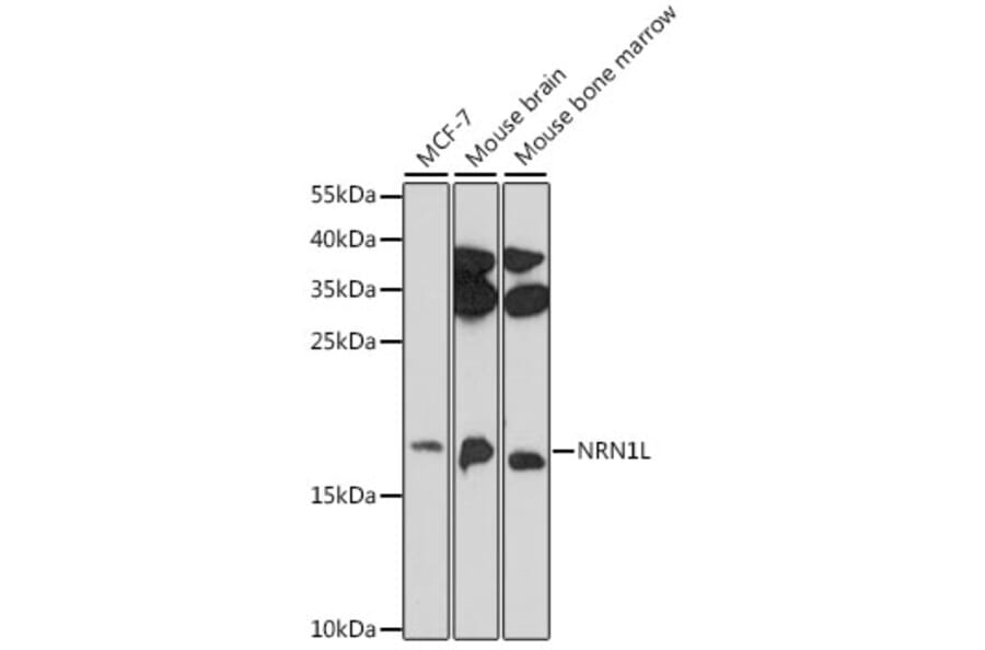 Western Blot - Anti-NRN1L Antibody (A88613) - Antibodies.com
