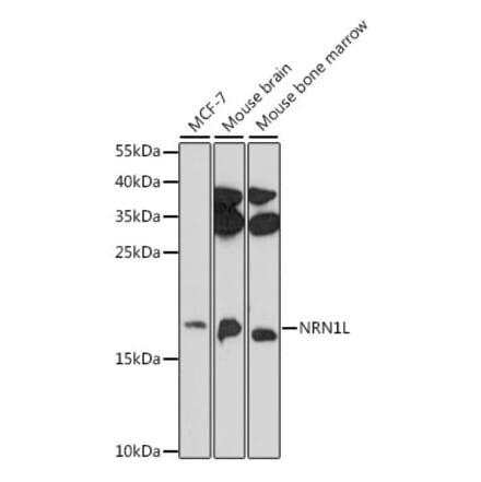 Western Blot - Anti-NRN1L Antibody (A88613) - Antibodies.com
